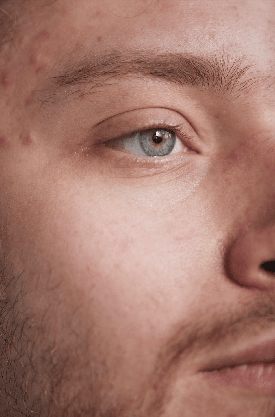 How to Heal Damaged Skin Barrier: Best Sunscreen for Dry Skin