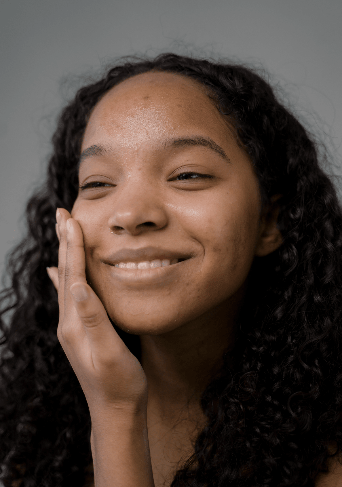 Exploring the Different Kinds of Hyperpigmentation and How to Prevent Them