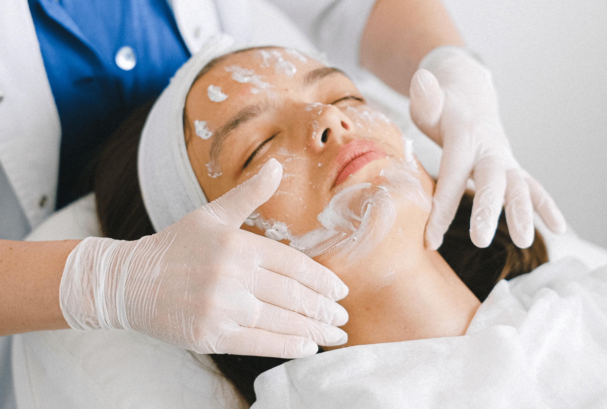 Skincare Tips After Chemical Peel: Best Sunscreen to Use With Exfoliation